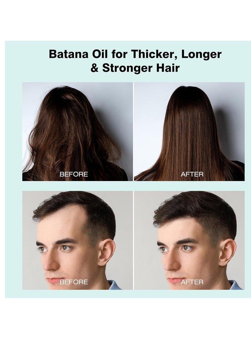 Raw Batana Oil for Hair Growth, 100% Pure Hair Growth Oil, Dr. Sebi Unrefined Batana Oil from Honduras, Prevents hair Loss, Hair Regrowth Treatment for Men Women - 5.3 oz