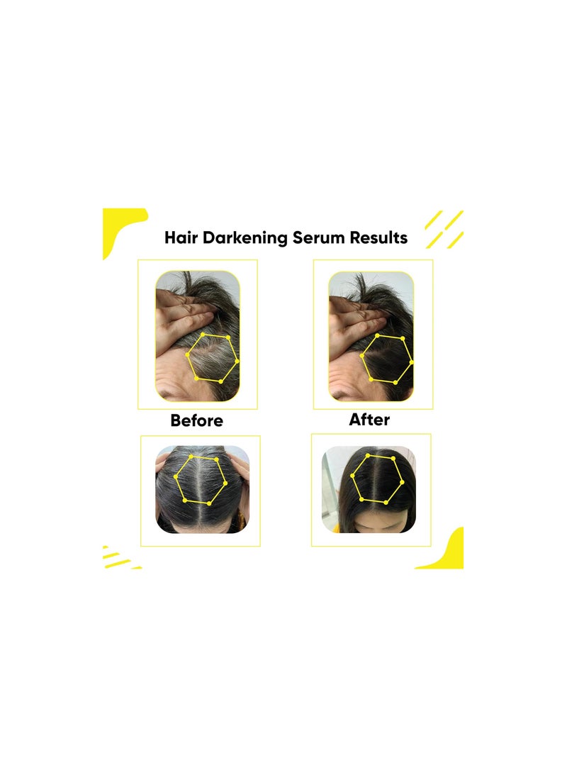 Masofta Anti Grey Hair Darkening Serum with Arcolys & Melano Gray For controlling Hair Greying | For Both Men & Women | Works for Hair & Beard | 30ML