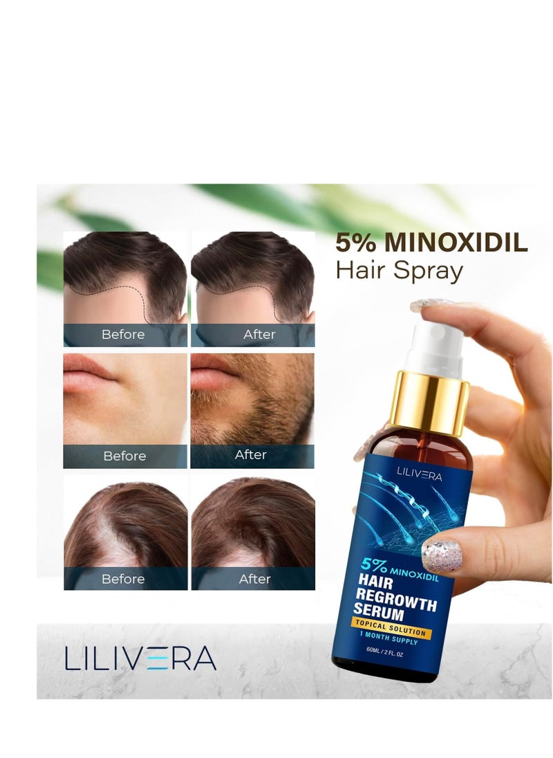 5% Minoxidil Hair Growth for Men and Women - 60mL Hair Growth Serum - Minoxidil Spray for Hair and Beard Regrowth - Hair Loss treatment - 1 Month Supply