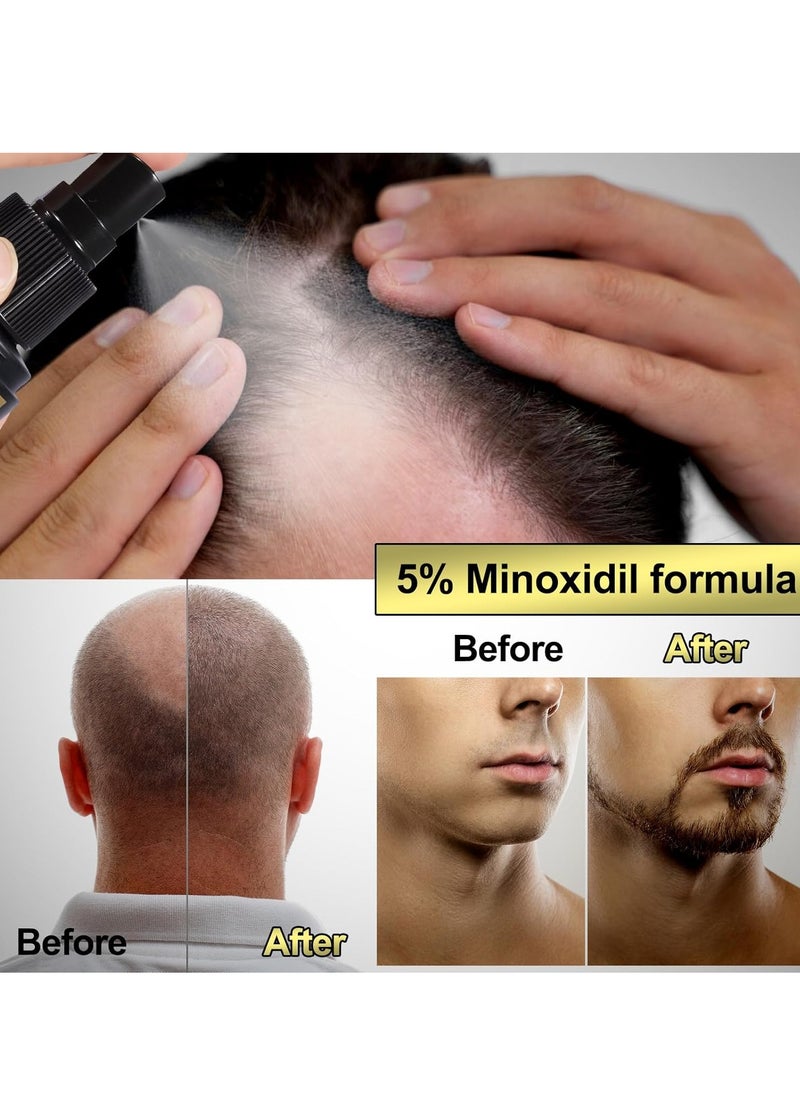 5% Minoxidil for Men Hair Growth Serum - Hair Regrowth Topical Spray Infused With Biotin - Thinning Hair and Anti Hair Loss Treatment Thicker Longer Fuller Healthier Hair 2 Month Supply