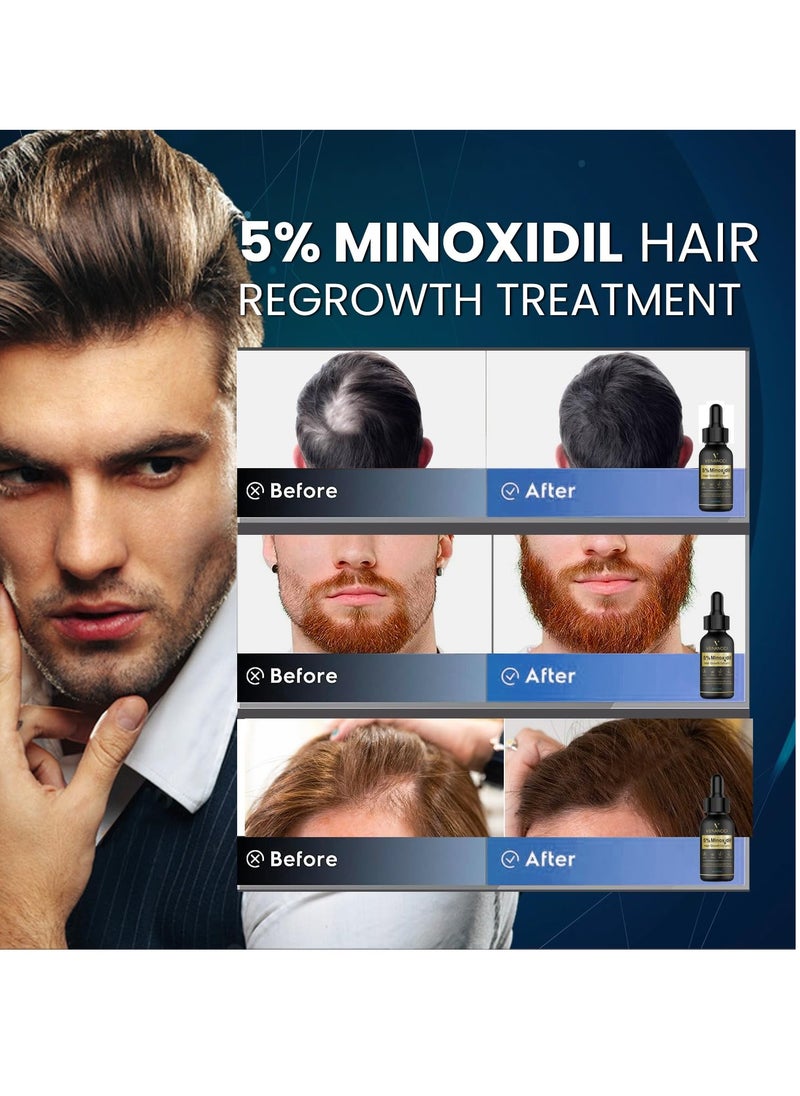 5% Minoxidil Hair Growth for Men and Women: Biotin Hair Growth Serum for Hair Loss, Thinning, and Faster Regrowth Treatment - 60ML