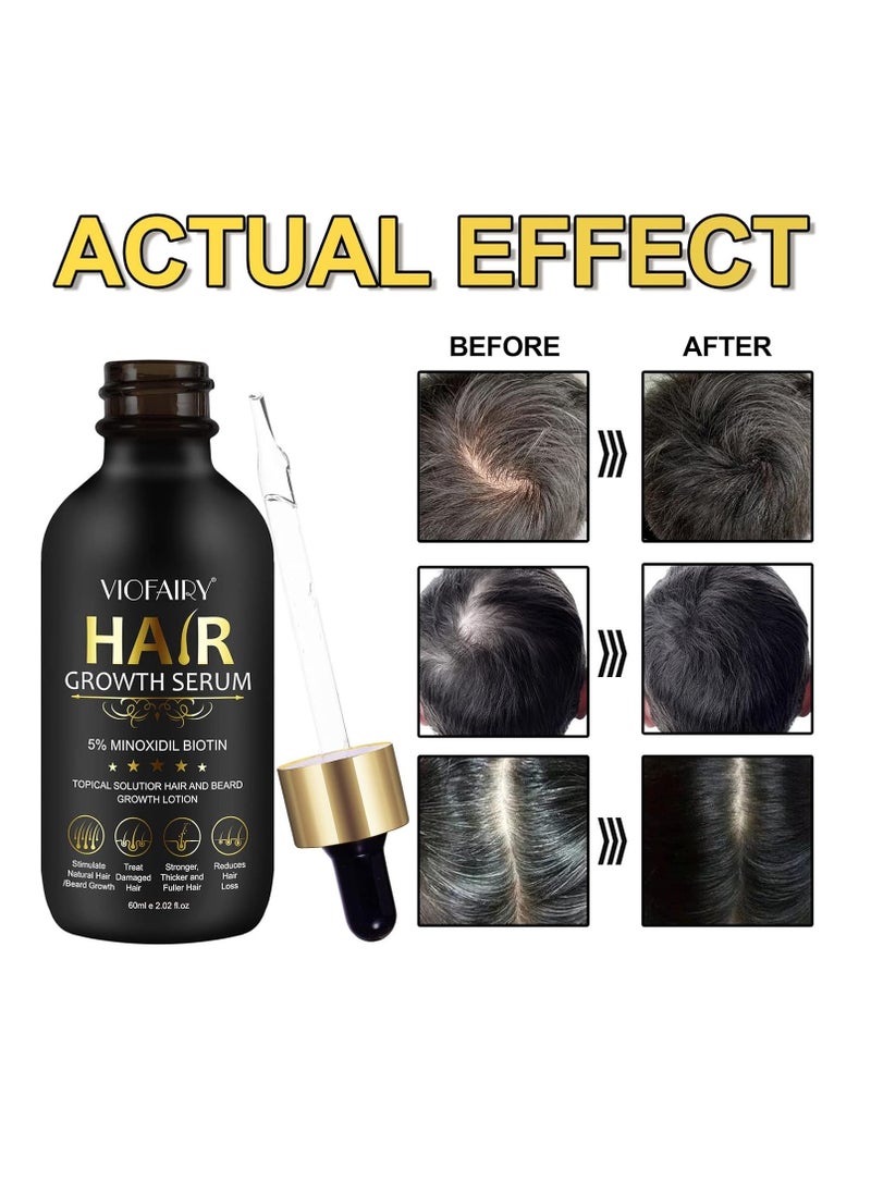5% Minoxidil for Men and Women - Biotin Hair And Beard Growth Serum & 5% Minoxidil Treatment for Stronger Thicker Longer – Natural Growth Thickening Treatment - Stop Thinning & Hair Loss-1Month supply