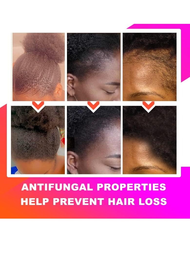 100% Naturals Chebe Hair Oil - SEVICH African Chebe Powder Serum, Hair Loss Treatments Repair Damaged Moisture Hair Regrowth Treatments 30ml