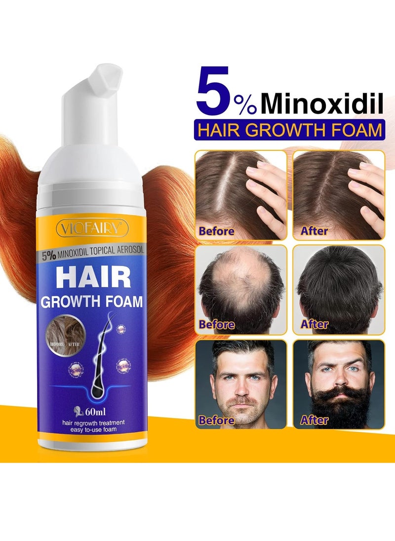 5% Minoxidil Hair Growth Foam - Unscented, For Men & Women, Helps Stop Hair Thinning & Loss, Natural Growth Treatment, Biotin, 2 Ounce (Pack of 2)