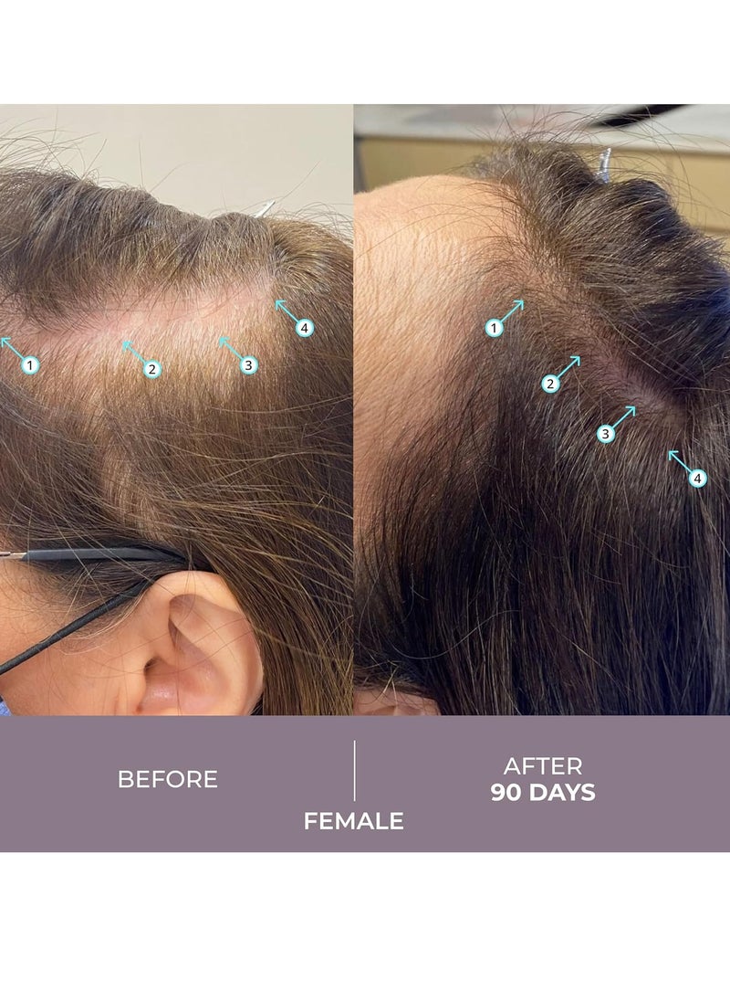 DS Laboratories Spectral.CSF Hair Regrowth Treatment for Women - Biotin Serum for Hair Growth, Thinning, and Thickening