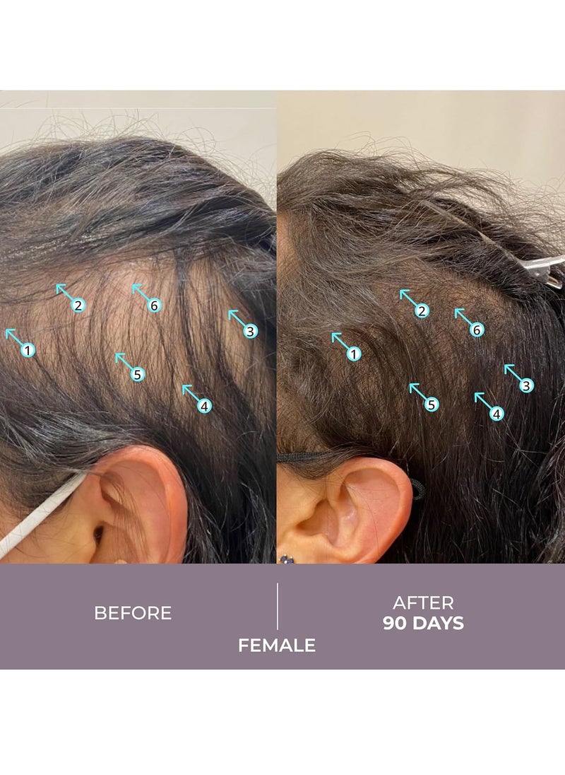 DS Laboratories Spectral.CSF Hair Regrowth Treatment for Women - Biotin Serum for Hair Growth, Thinning, and Thickening