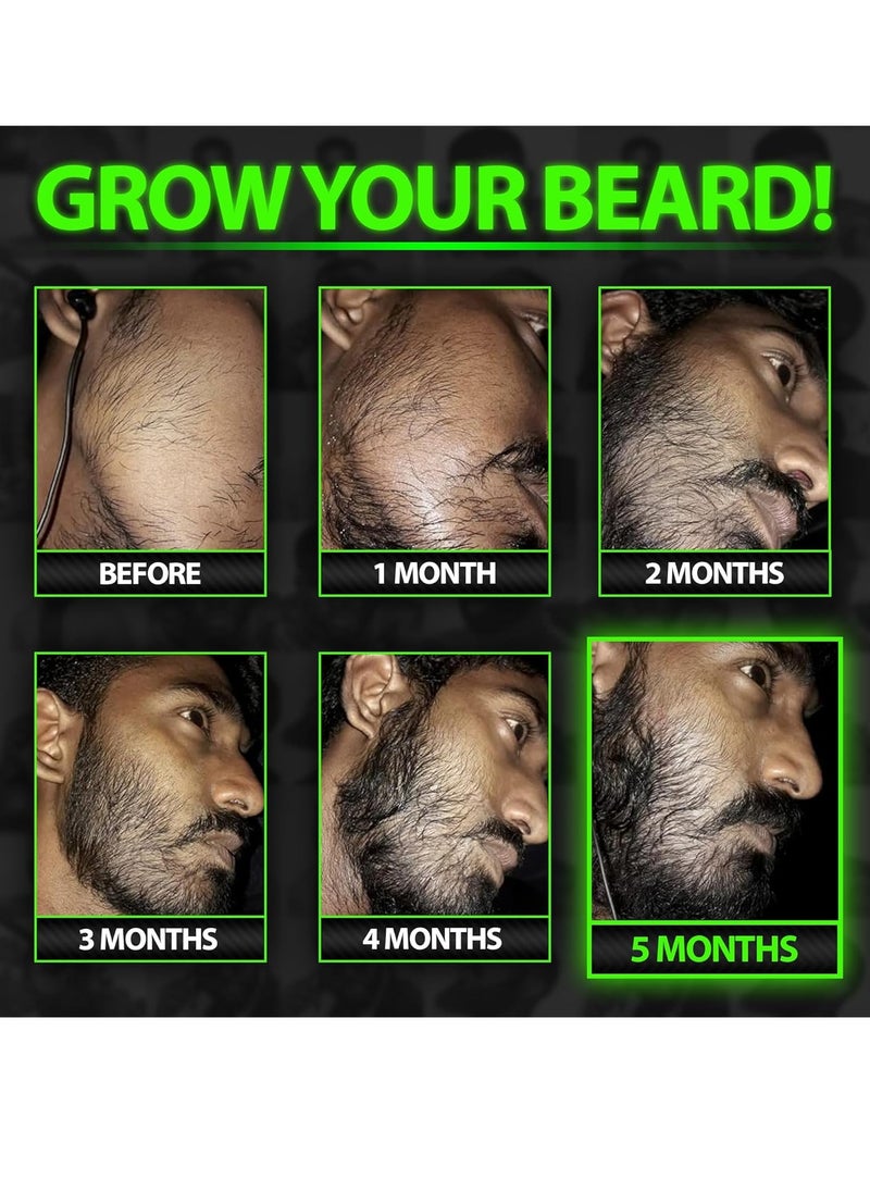 GROW Maximum XXL Hair & Beard Growth Oil For Men • Beard Growth Serum That Fills Patches & Fix Thinning GUARANTEED • Facial Hair & Scalp Treatment • Thickening Conditioner & Enhancer • Made in the USA