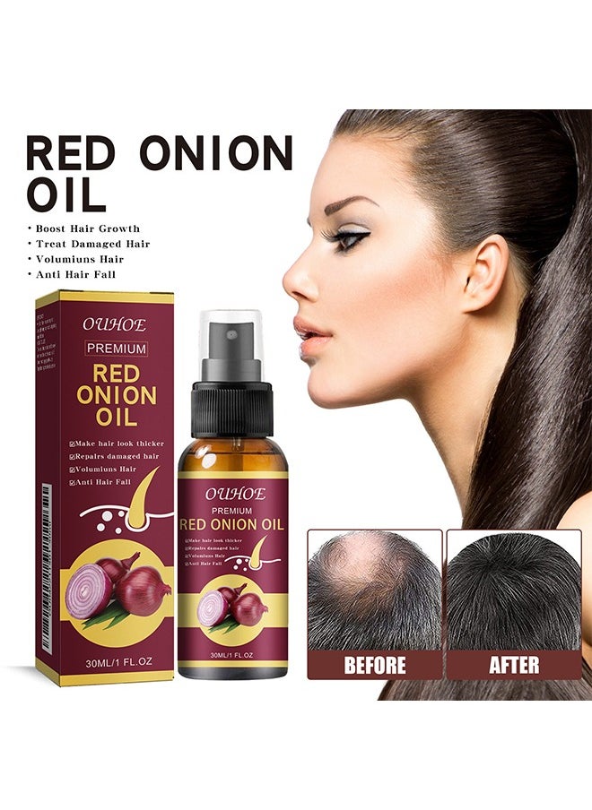 Premium Red Onion Oil，Hair Oil with , Red Onion Extraxt, Castor Oil and Coconut Oil- Organic Formula for Hair Growth and Hair Loss Control 30ML