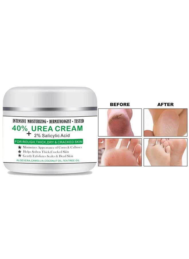 40% Urea Cream and 2% Salicylic Acid, Moisturizing Hand and Foot Cream for Chapped Chapped Hands, Softening and Thickening of the Skin, Hand and Foot Exfoliation Moisturizing Cream - 100g ﻿