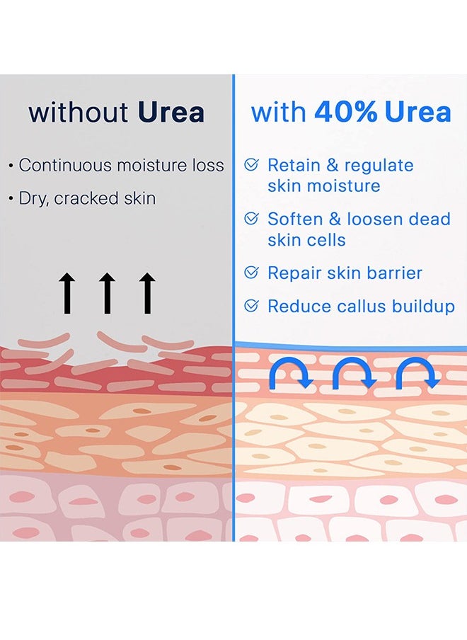 40% UREA CREAM+2% Salicylic Acid，Callus Remover Hand Cream Foot Cream For Dry Cracked Feet, Hands, Heels, Elbows, Nails, Knees, Intensive Moisturizes & Softens Skin, Exfoliates Dead Skin-50g