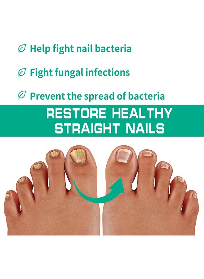 Nail Fungus Ointmen，Gray Nail Cream - Thickening, Brightening, and Repairing Solution for Damaged Nails on Hands and Feet. -20g