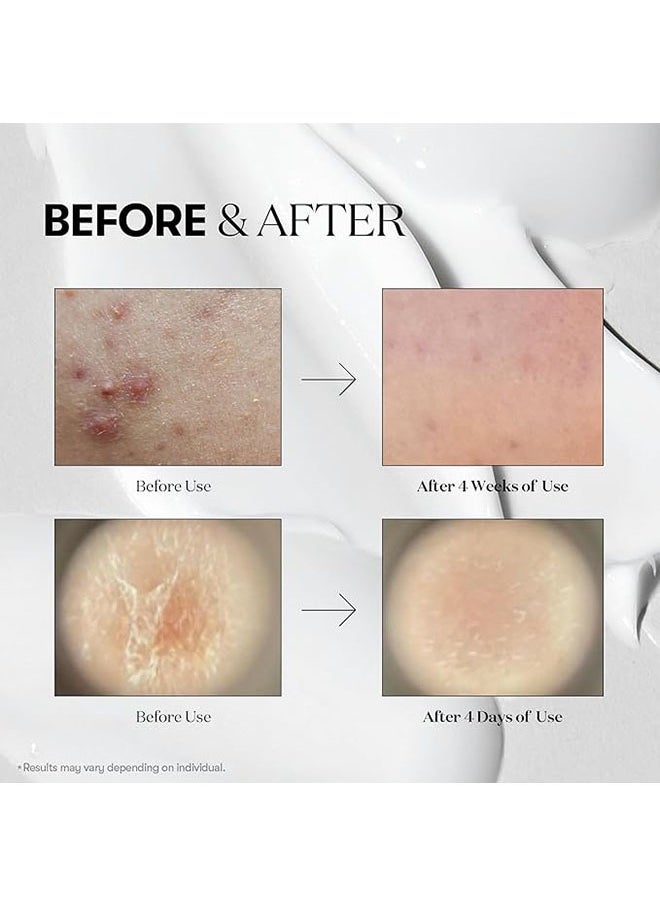 Mild Reedle Shot 50, Day and Night Repairing Essence for Dull, Tired Skin, Repair Acne and Pimples, Daily Skin Care, 50ml