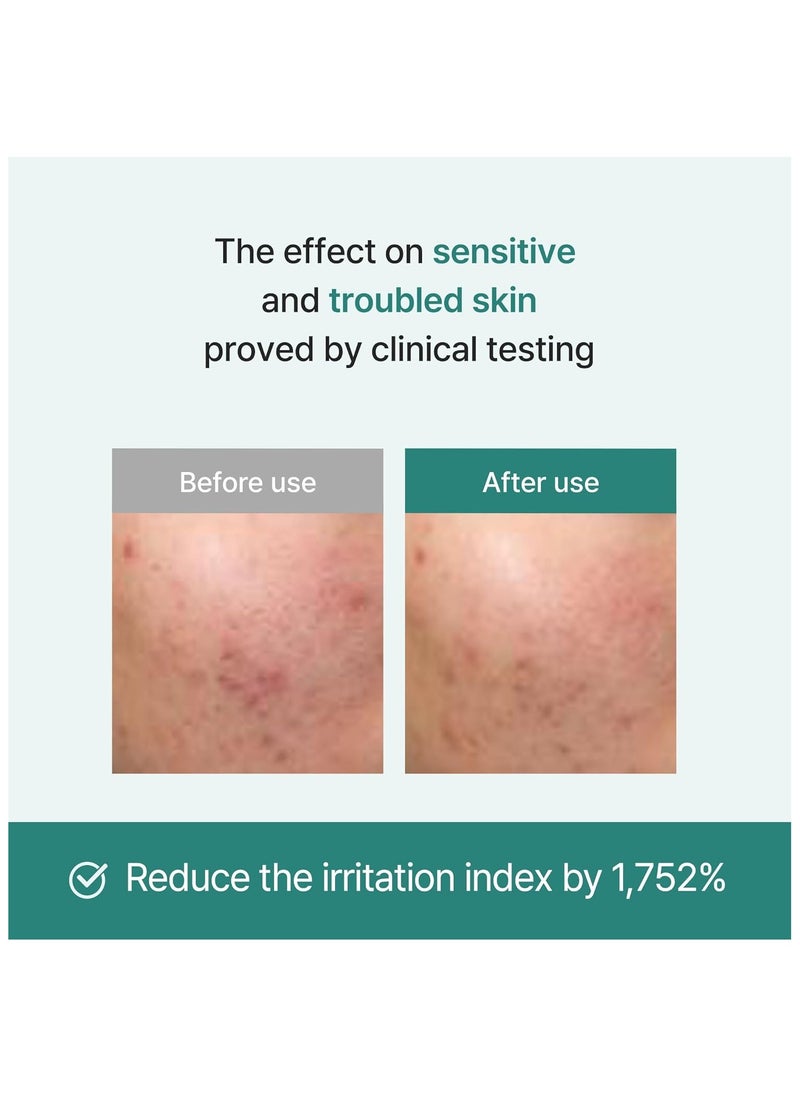 I'm from Licorice Soothing Ampoule, 73% Korean Licorice, Exosome, Non-comedogenic 30ml