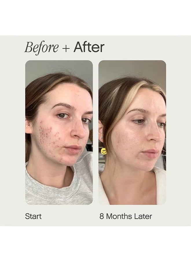 Topicals Brightening and Clearing Serum | Reduces Discoloration, Post-Blemish Marks, Scars and Spots | Contains Kojic Acid and Niacinamide | Dermatologist-tested, Vegan, Cruelty-Free (50ml/1.7 Fl Oz)