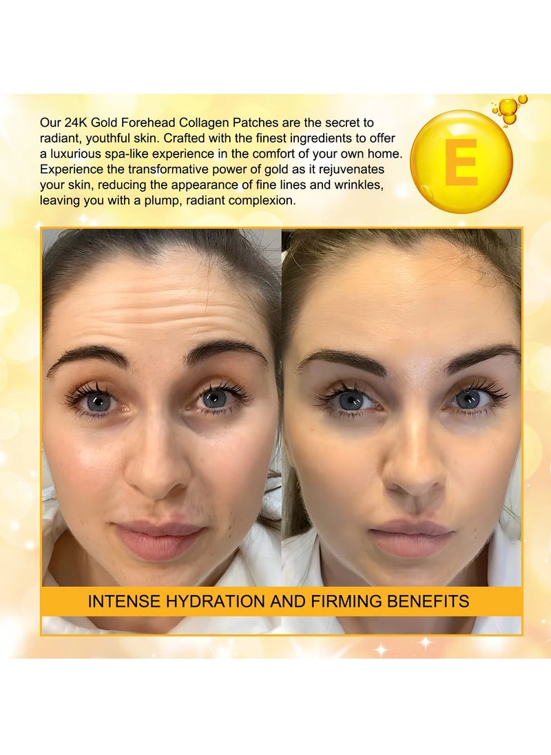12Pcs 24K Gold Forehead Collagen Patches Forehead Wrinkle Patches with Aloe Vera Collagen Shea Butter and Vitamin E Smooth Fine Line and Wrinkles Anti Wrinkle Forehead Wrinkle Treatment Patch