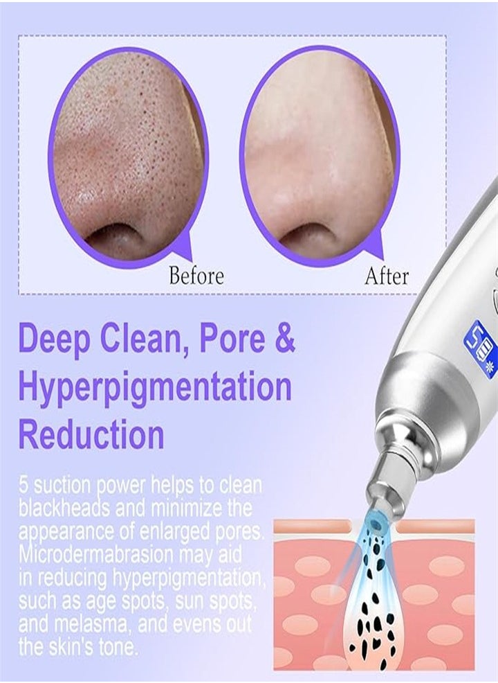 Portable diamond microdermabrasion machine, handheld, blackhead removal, facial skin care, acne scar beauty instrument