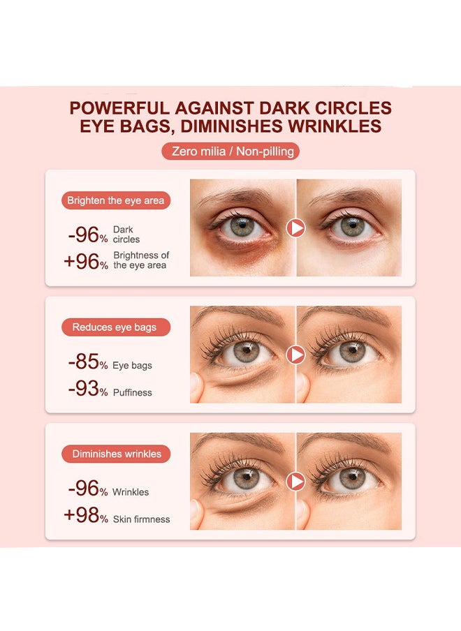 Anti Dark Circles And Eye Bags Cream , Fade Dark Circles, Remove Fine Lines and Eye Bags, Anti-Wrinkle Anti-Aging Firming Brighten Skin Cream, Eye Care Cream 20g