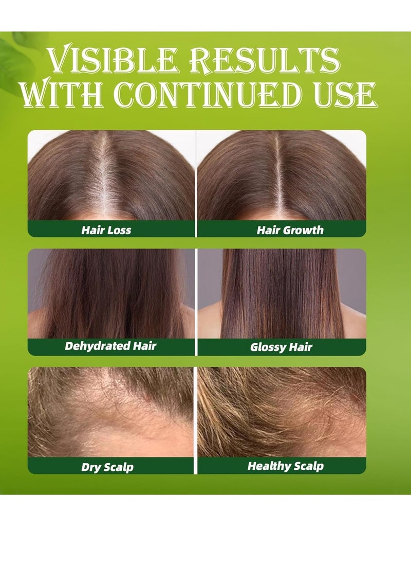 Batana Oil Shampoo, Batana Shampoo for Hair Growth, Natural Hair Loss Shampoo for Thinning Hair, Suitable for All Hair Types, Strengthening and Regrowth Formula, 3.38 Fl. Oz