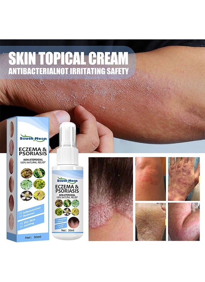 Eczema & Psoriasis Non-Steroidal100% Natural Relief，Dermatitis And Eczema Pruritus Psoriasis Spray, Say Goodbye To Scaly Skin, Eczema Relief Spray, Stops Burning And Itching 30ML