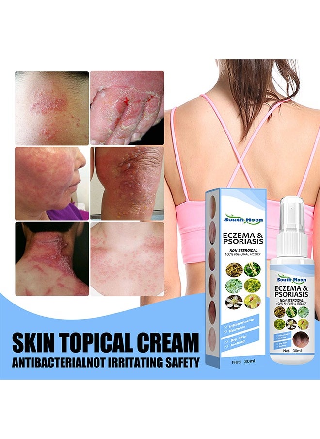 Eczema & Psoriasis Non-Steroidal100% Natural Relief，Dermatitis And Eczema Pruritus Psoriasis Spray, Say Goodbye To Scaly Skin, Eczema Relief Spray, Stops Burning And Itching 30ML