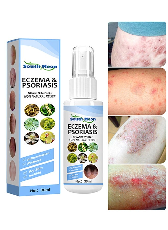 Eczema & Psoriasis Non-Steroidal100% Natural Relief，Dermatitis And Eczema Pruritus Psoriasis Spray, Say Goodbye To Scaly Skin, Eczema Relief Spray, Stops Burning And Itching 30ML