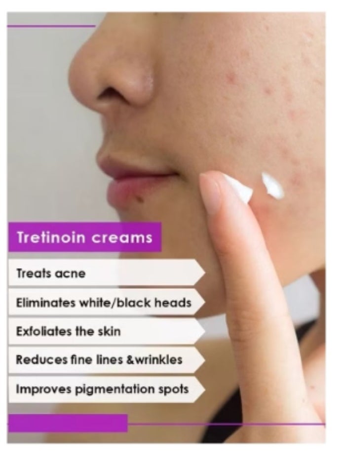 Skin Care Set for the Optimal and Ultimate Treatment for Acne and Skin Problems(Acretin 0.05% Acne Cream 30 gm + Hi Quin Pro Whitening Exfoliating Acne Treatment 4% Cream 30 gm + Acretin 0.025% Cream 30 gm)