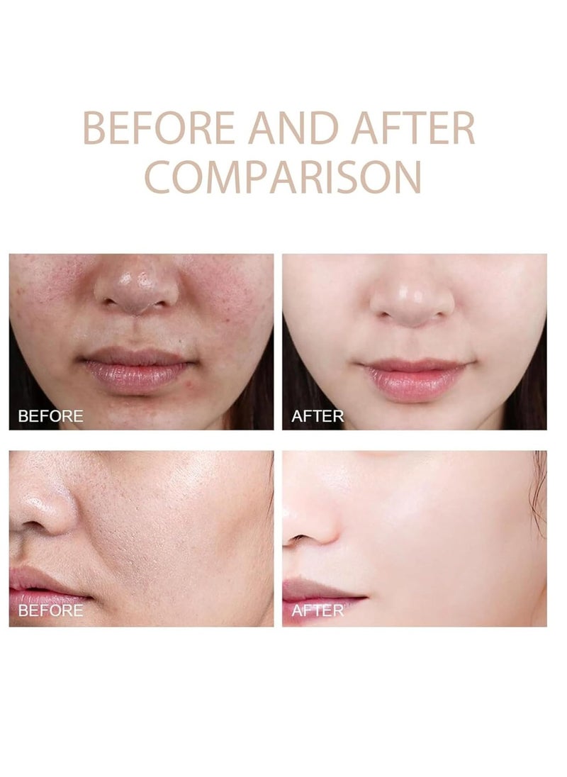 2PCS Purifying Exfoliating Gel,Exfoliating Gel, Purifying Exfoliating Moisturizing Gel, Facial Purifying Exfoliator Cleanser ﻿