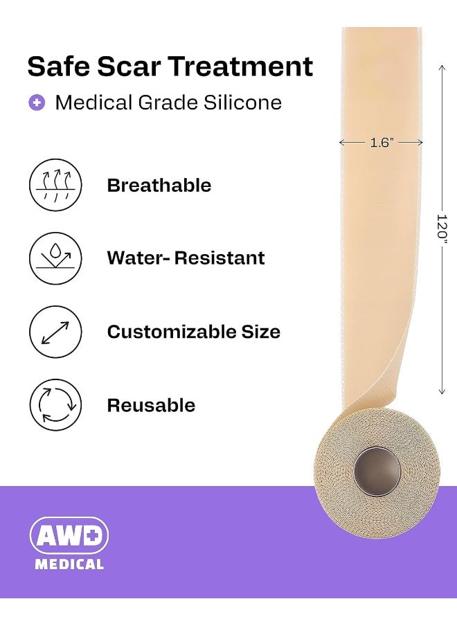 AWD Medical Soft Silicone Tape for Scars Removal with Silicone Gel Sheeting (1.6inx 120in)