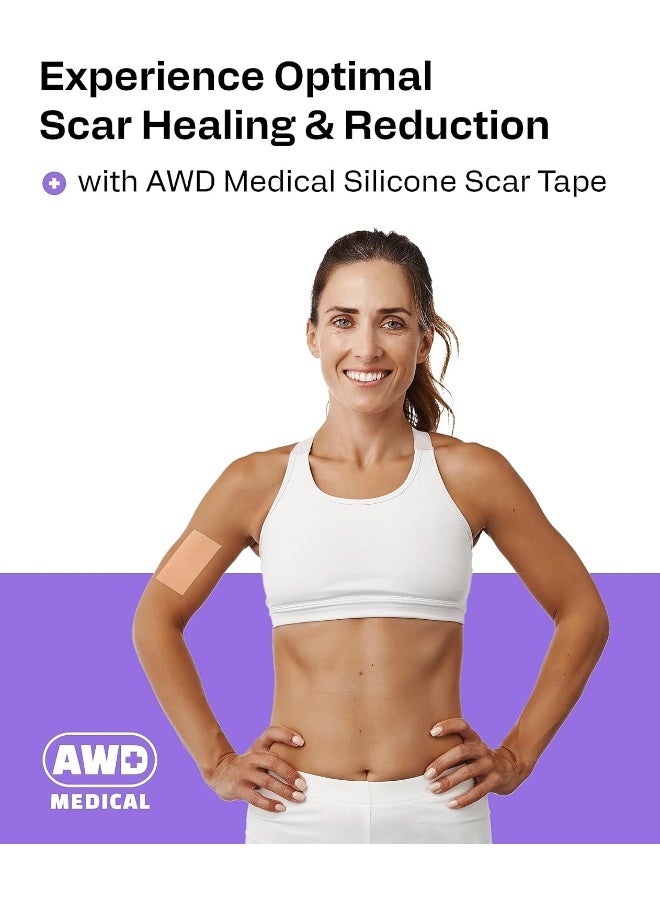 AWD Medical Soft Silicone Tape for Scars Removal with Silicone Gel Sheeting (1.6inx 120in)