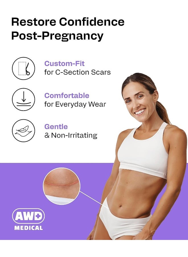 AWD Medical Soft Silicone Tape for Scars Removal with Silicone Gel Sheeting (1.6inx 120in)
