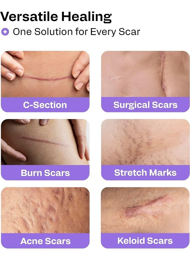 AWD Medical Soft Silicone Tape for Scars Removal with Silicone Gel Sheeting (1.6inx 120in)