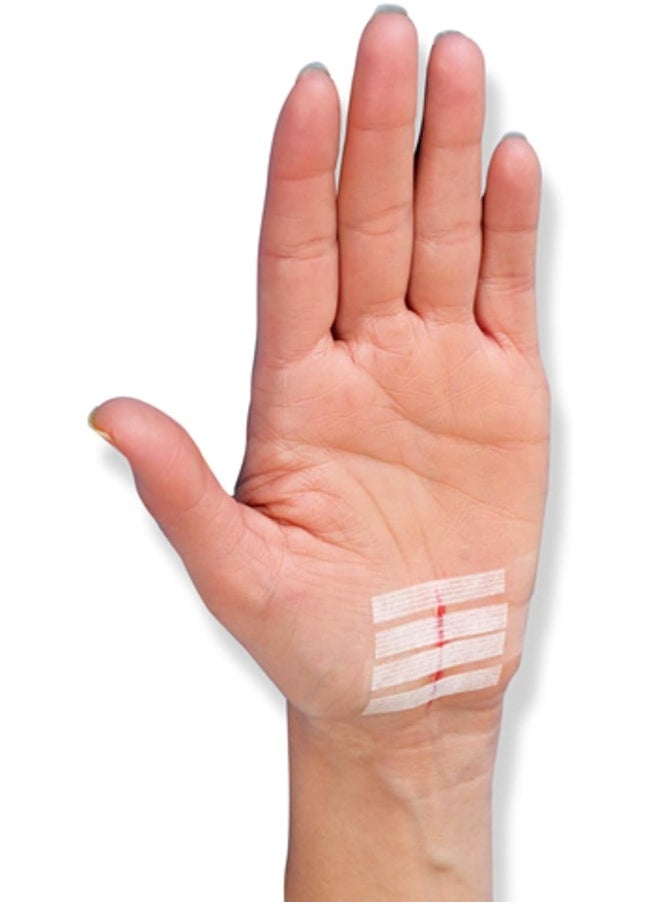 Nexcare Steri-Strip Wound Closure, 30 Count