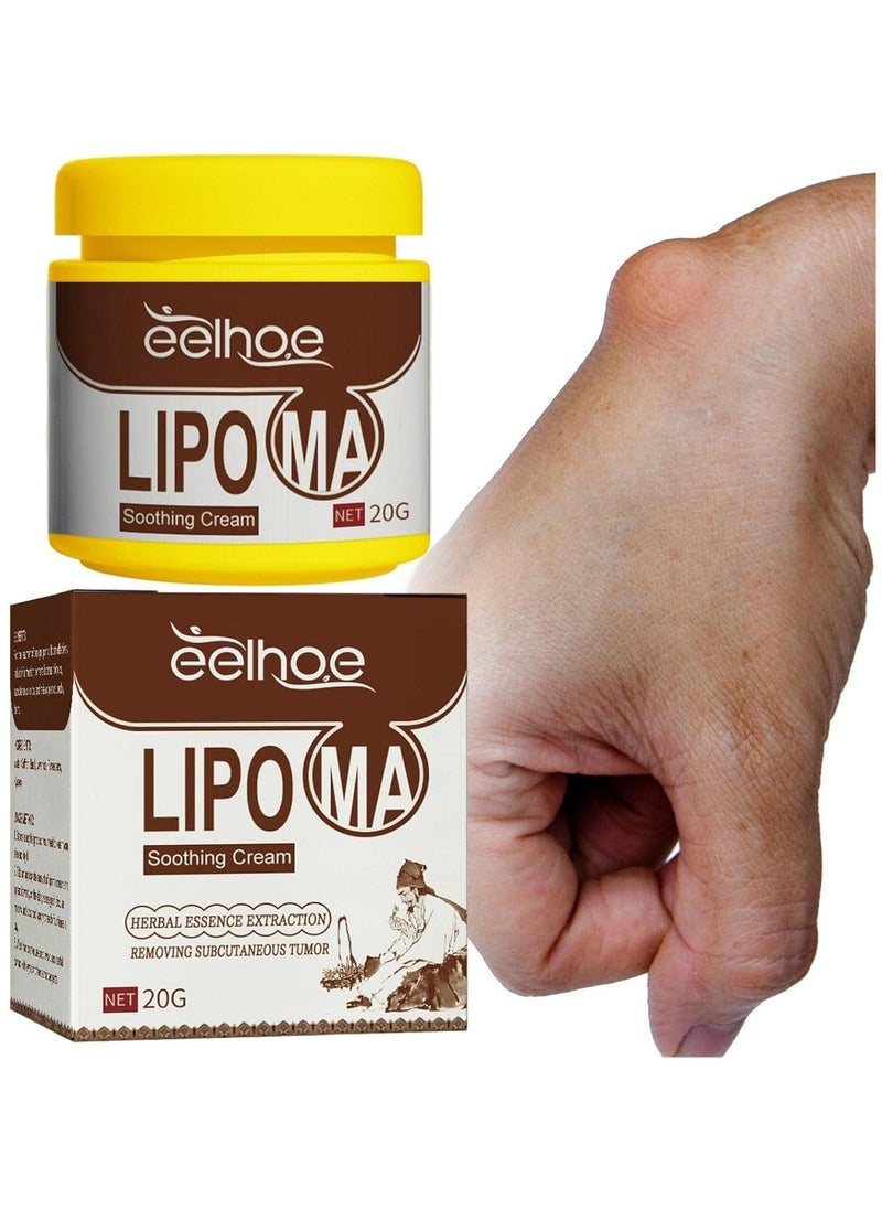 Lipoma Removal Cream,Natural Herbal Body Care Balm | Instant Lipoma Removal Cream Ointment for Subcutaneous Lumps and Various Fat Agglomerates, Relieving