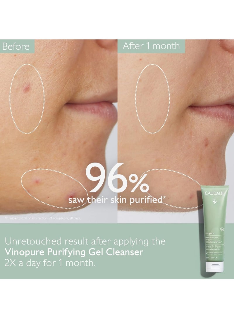 Vinopure Pore Purifying Gel Cleanser with Natural Salicylic Acid 5 Fl OzFluid Ounce