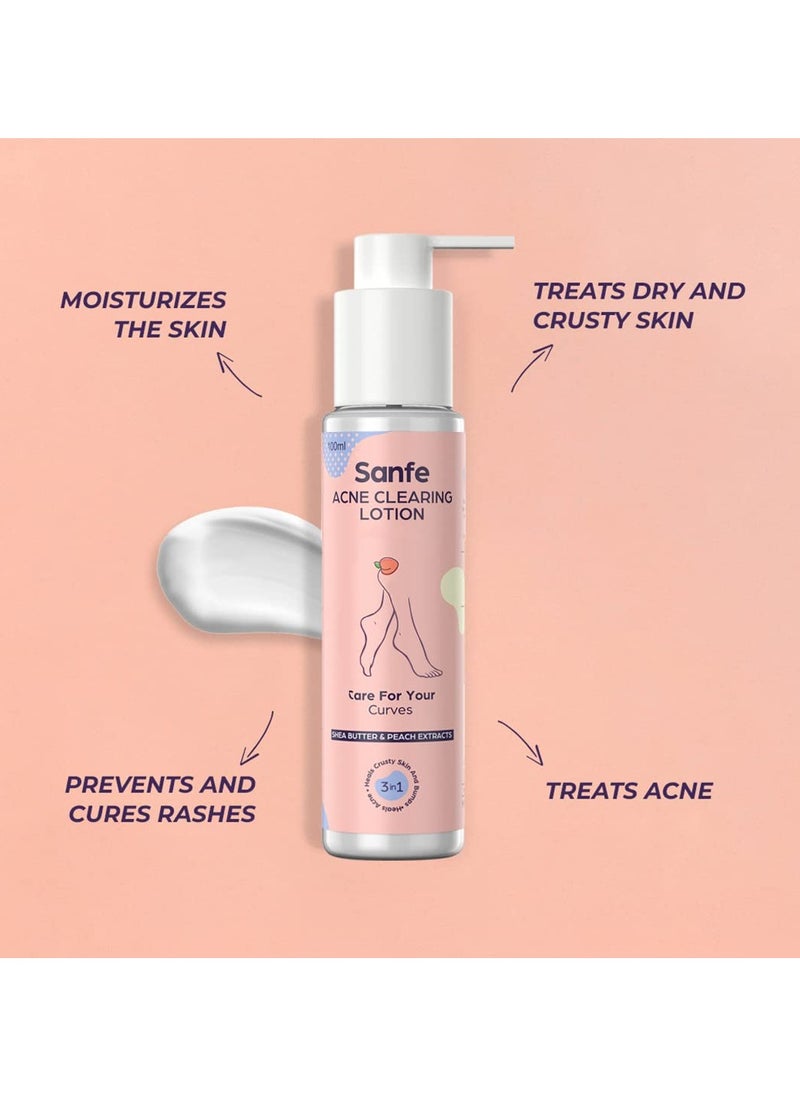 Acne Clearing Lotion Ingrowns Dry Crusty Skin 10X Power Shea Butter Exfoliation Lightening 24Hr Moisture 100ml