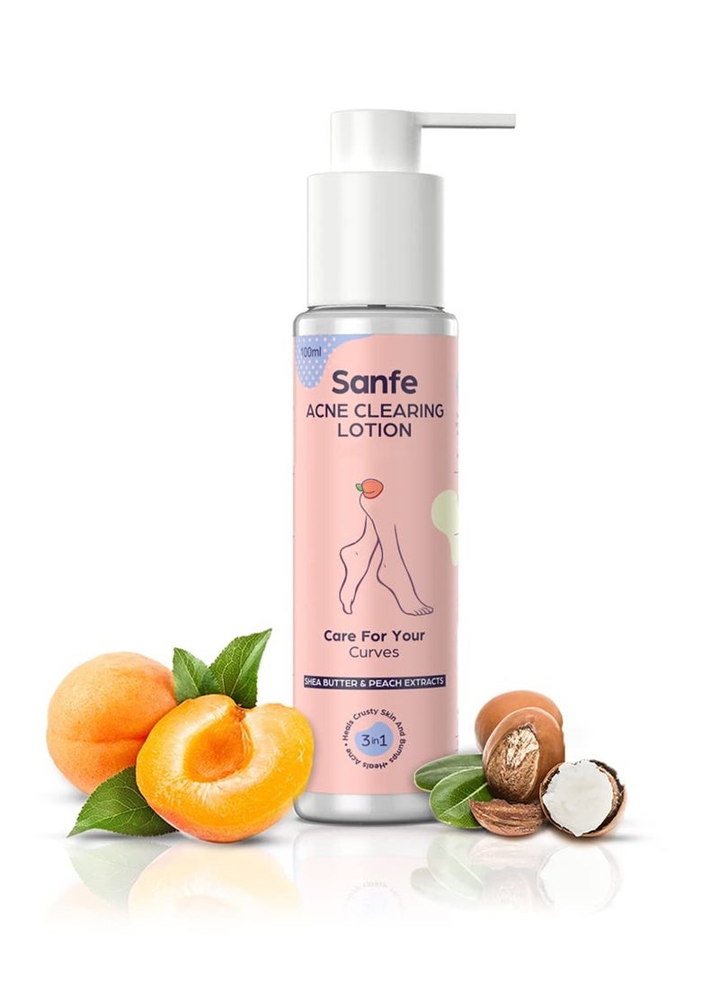 Acne Clearing Lotion Ingrowns Dry Crusty Skin 10X Power Shea Butter Exfoliation Lightening 24Hr Moisture 100ml
