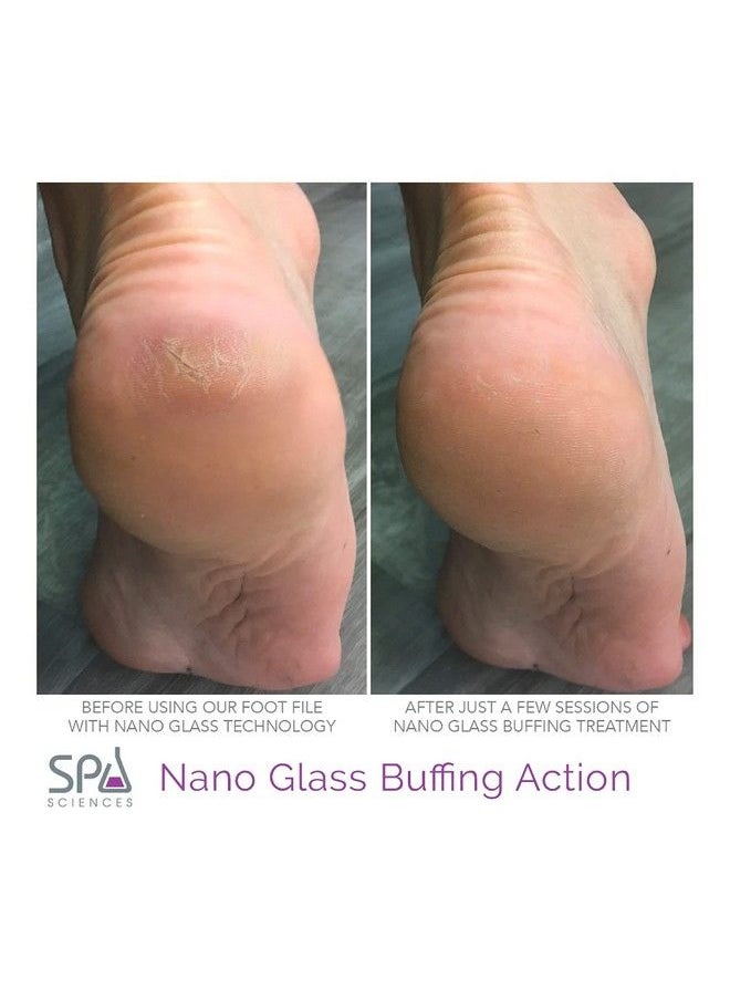 Nano Glass Foot File Exfoliating Pedi Tool Targets Dry Skin Corns Calluses For Use On Wet Or Dry Skin All Skin Types