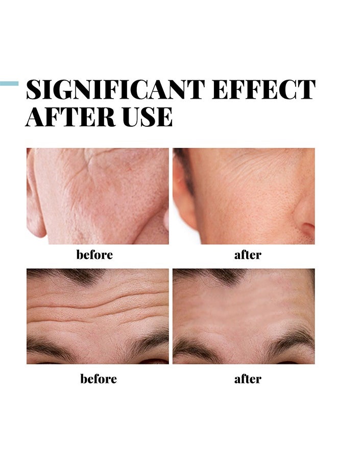 Collagen Cream, for Men Contains Retinol, Hyaluronic Acid, and Vitamin E, Has Anti Wrinkle Cream, Facial Moisturizing, Anti-Aging and Wrinkle Antioxidant Effects 30g Collagen Cream, for Men Contains Retinol, Hyaluronic Acid, and Vitamin E, Has Anti Wrinkle Cream, Facial Moisturizing, Anti-Aging and Wrinkle Antioxidant Effects 30g