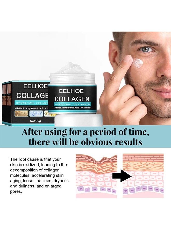 Collagen Cream, for Men Contains Retinol, Hyaluronic Acid, and Vitamin E, Has Anti Wrinkle Cream, Facial Moisturizing, Anti-Aging and Wrinkle Antioxidant Effects 30g Collagen Cream, for Men Contains Retinol, Hyaluronic Acid, and Vitamin E, Has Anti Wrinkle Cream, Facial Moisturizing, Anti-Aging and Wrinkle Antioxidant Effects 30g
