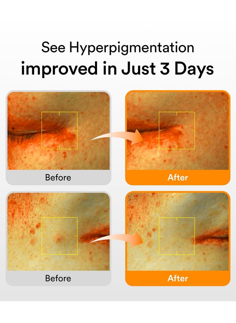 Abib Glutathiosome dark spot serum Vita drop 50ml