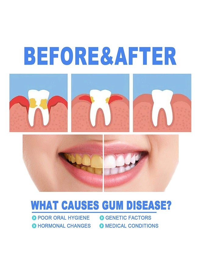 Gum Protect Repair Gels-Teeth Whitening,Remove Deep Dirt ,Restore Oral Health for Men and Women 4ml