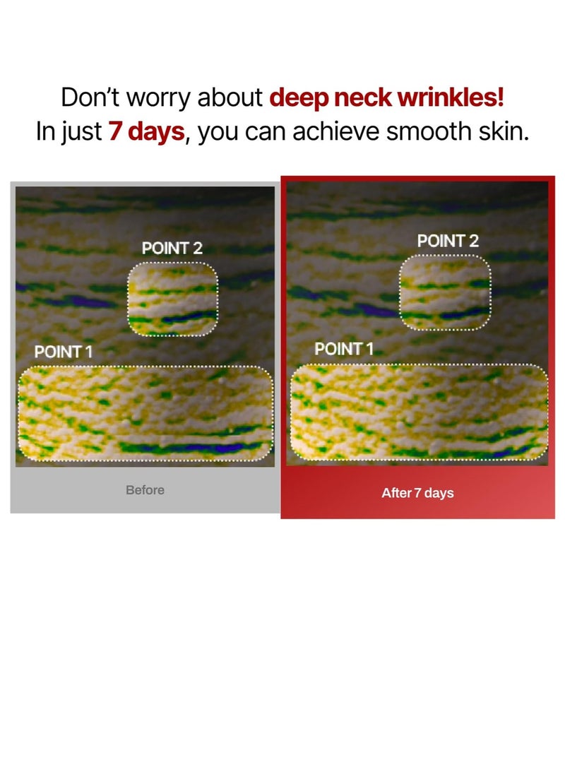 MEDITHERAPY Wrinkle fit Korean Mesh Sheet Masks for Neck | 7EA