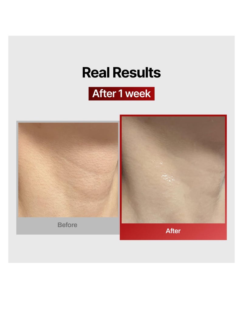 MEDITHERAPY Wrinkle fit Korean Mesh Sheet Masks for Neck | 7EA