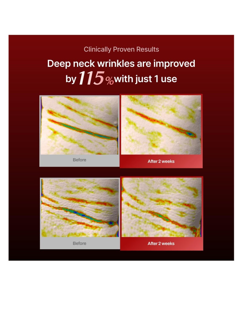 MEDITHERAPY Wrinkle fit Korean Mesh Sheet Masks for Neck | 7EA