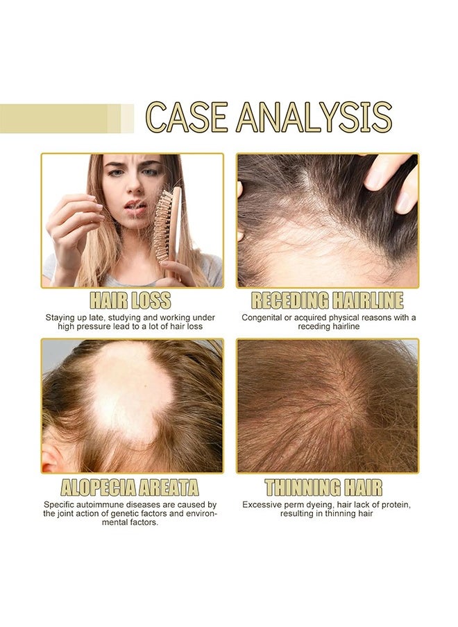 Hair Growth Oil, Rosemary Hair Growth Essential Oil, Anti Hair Loss Fast Regrowth Essence, Repair Damaged Frizzy Thinning Scalp Hair-restorer Dense, Hair Growth Serum, 60ml/2 fl.oz