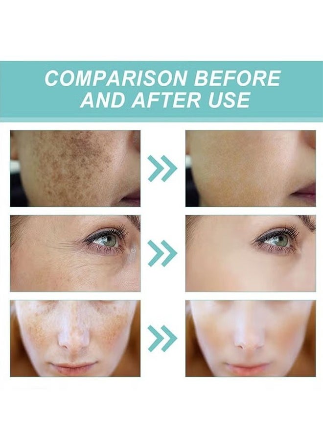 Dark Spot Corrector Remover Cream 30g, Hyperpigmentation and Melasma Treatment, Moisturizes and Nourishes Skin, Whitening Moisturizing Brighten, Complexion Improving Skin, Remover Dark Spot Cream