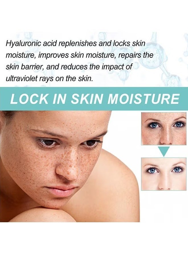Dark Spot Corrector Remover Cream 30g, Hyperpigmentation and Melasma Treatment, Moisturizes and Nourishes Skin, Whitening Moisturizing Brighten, Complexion Improving Skin, Remover Dark Spot Cream