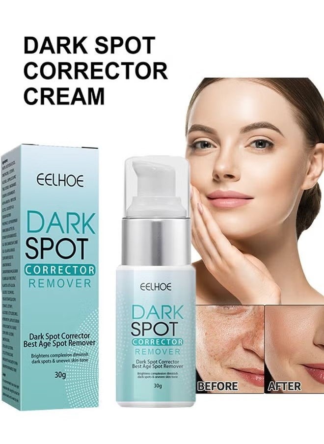 Dark Spot Corrector Remover Cream 30g, Hyperpigmentation and Melasma Treatment, Moisturizes and Nourishes Skin, Whitening Moisturizing Brighten, Complexion Improving Skin, Remover Dark Spot Cream