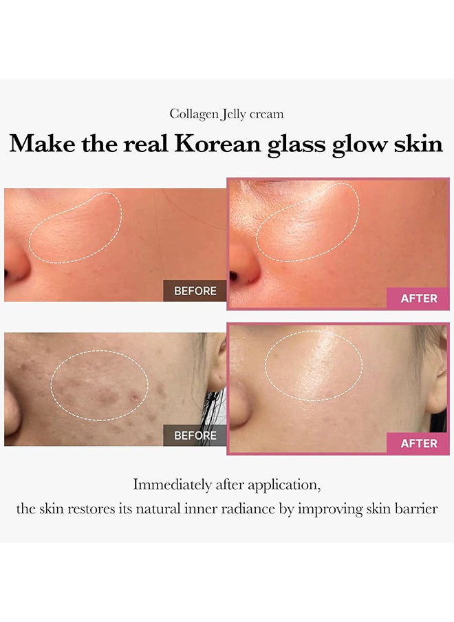 Collagen Jelly Cream, Boost Elasticity And Hydration, Reduce Fine Lines And Dullness, 100ml