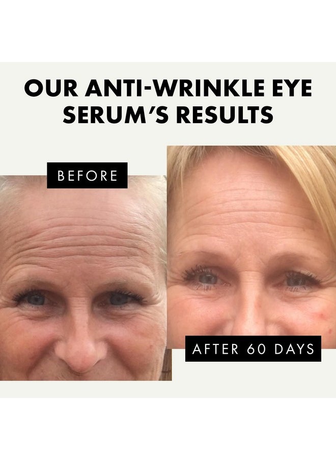 ??? ????* Eye Serum - Under Eye Cream For Dark Circles And Puffiness - Anti Aging Eye Cream, Under Eye Brightener Eye Bags Eye Treatment, Caffeine Eye Cream Puffy Eyes Treatment Dark Circle